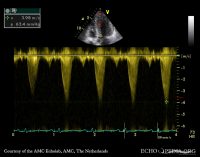 EpiCor Therapeutics wins UCD Start-up of the Year Award